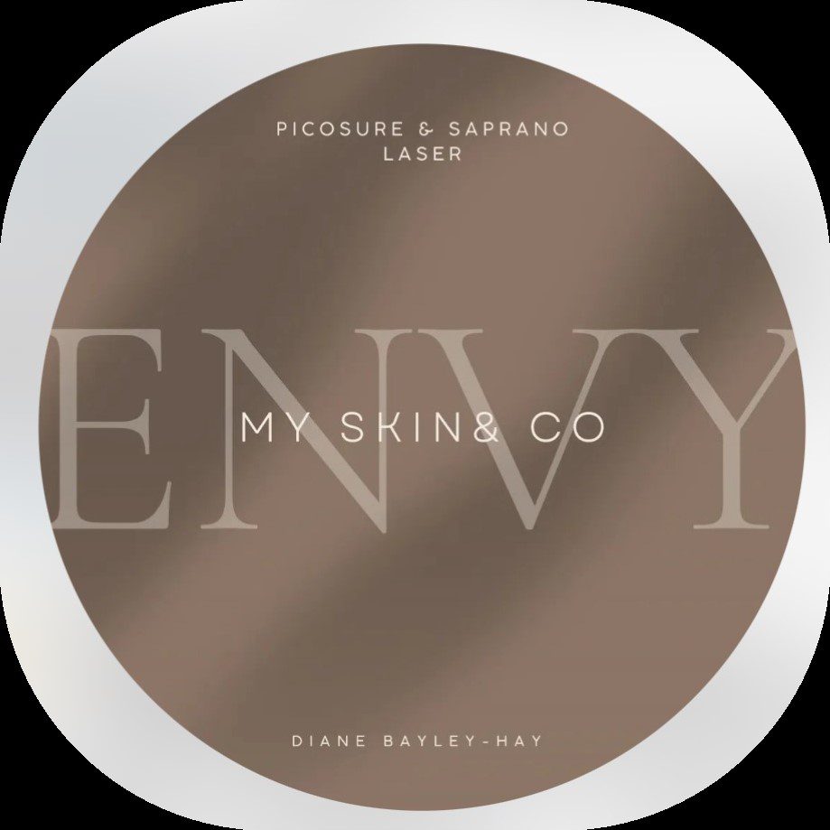 envy 1
