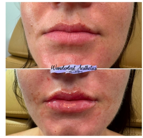 Screenshot 14 12 2024 22123 www.instagram.com