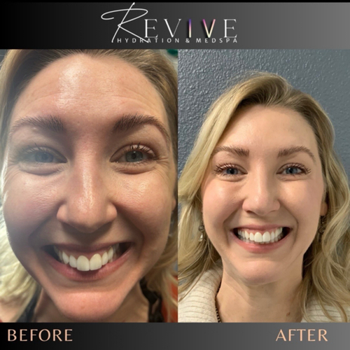 image processing20250326 66 pkd6sm 1