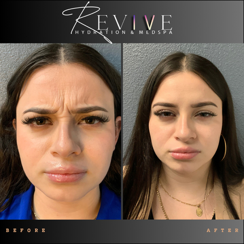 image processing20250531 47 rba4vh