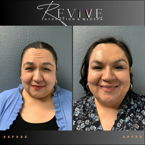 image processing20250702 74 wjt77e 1