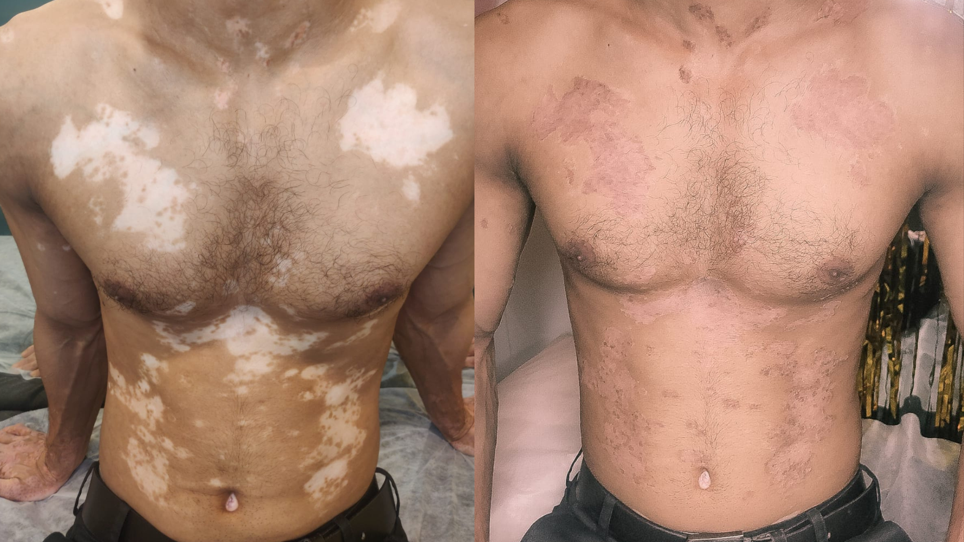 Mini Patankar www.tattoosbythebay.com Tattoos by the bay walnut creek CA 3